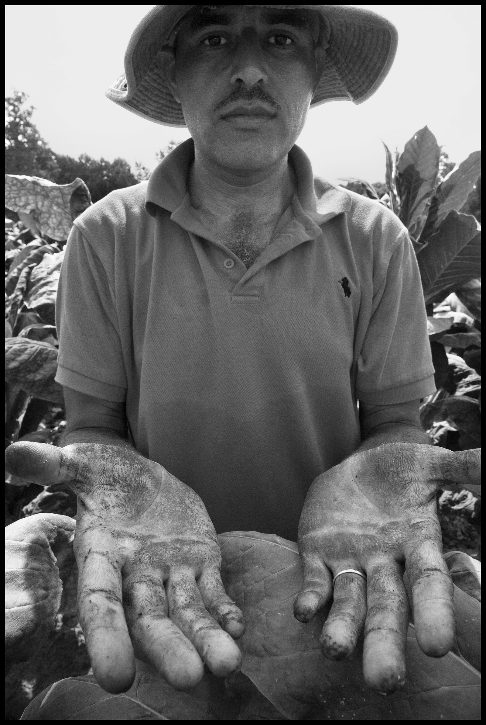 Tobacco farmer shows his injured hands